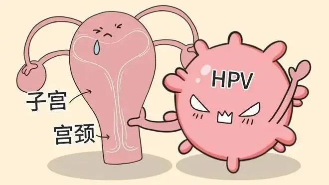 隐瞒HPV致女友感染男子被判赔偿1.5万元